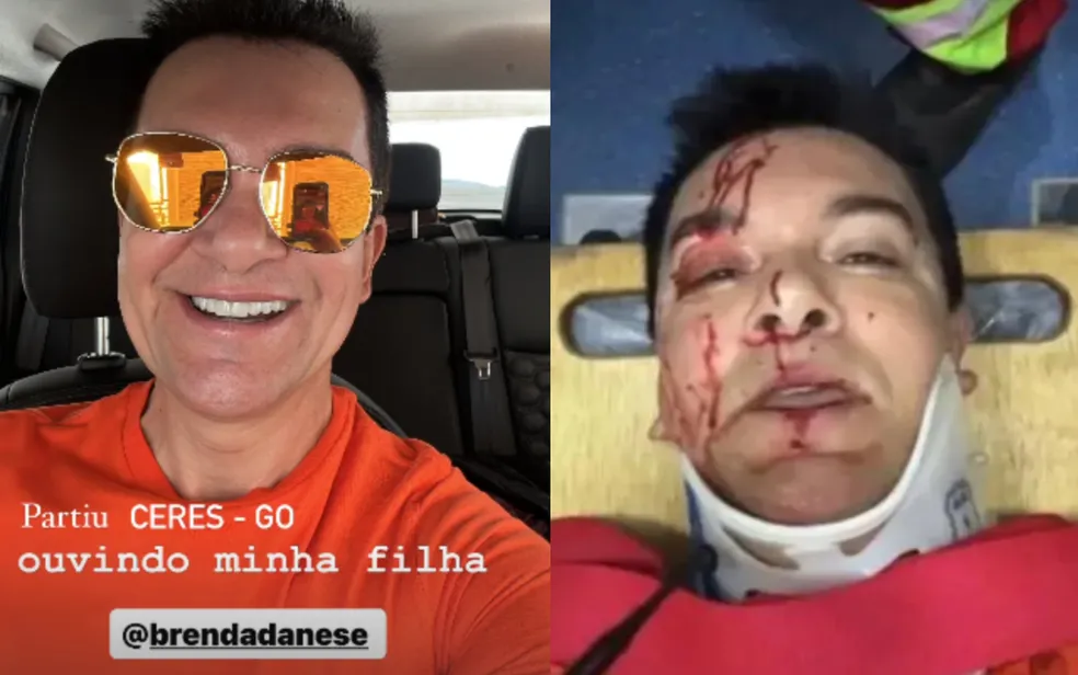 Foto postada do cantor gospel Régis Danese em suas redes sociais após o acidente